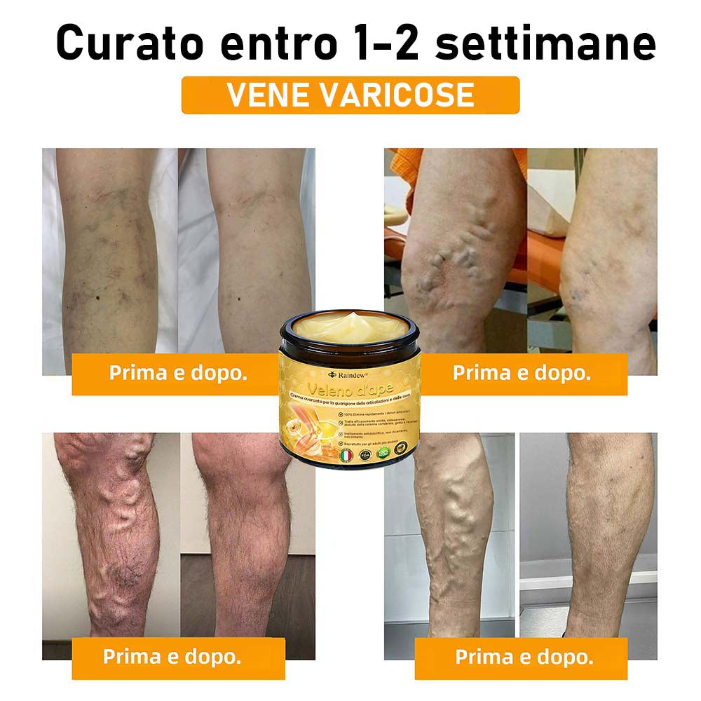 Raindew® Crema Avanzata al Veleno d'Ape per la Guarigione delle Articolazioni e delle Ossa