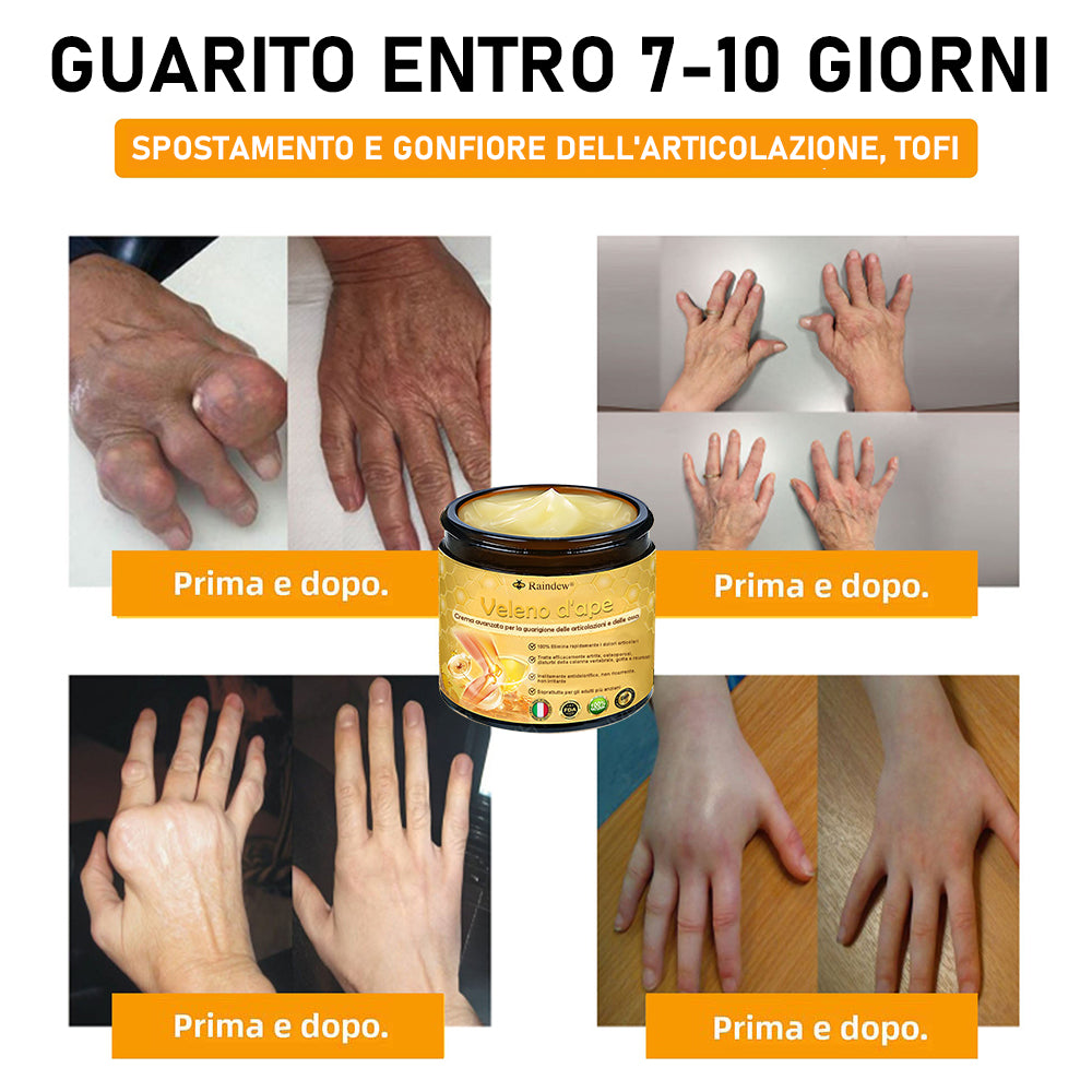 Raindew® Crema Avanzata al Veleno d'Ape per la Guarigione delle Articolazioni e delle Ossa