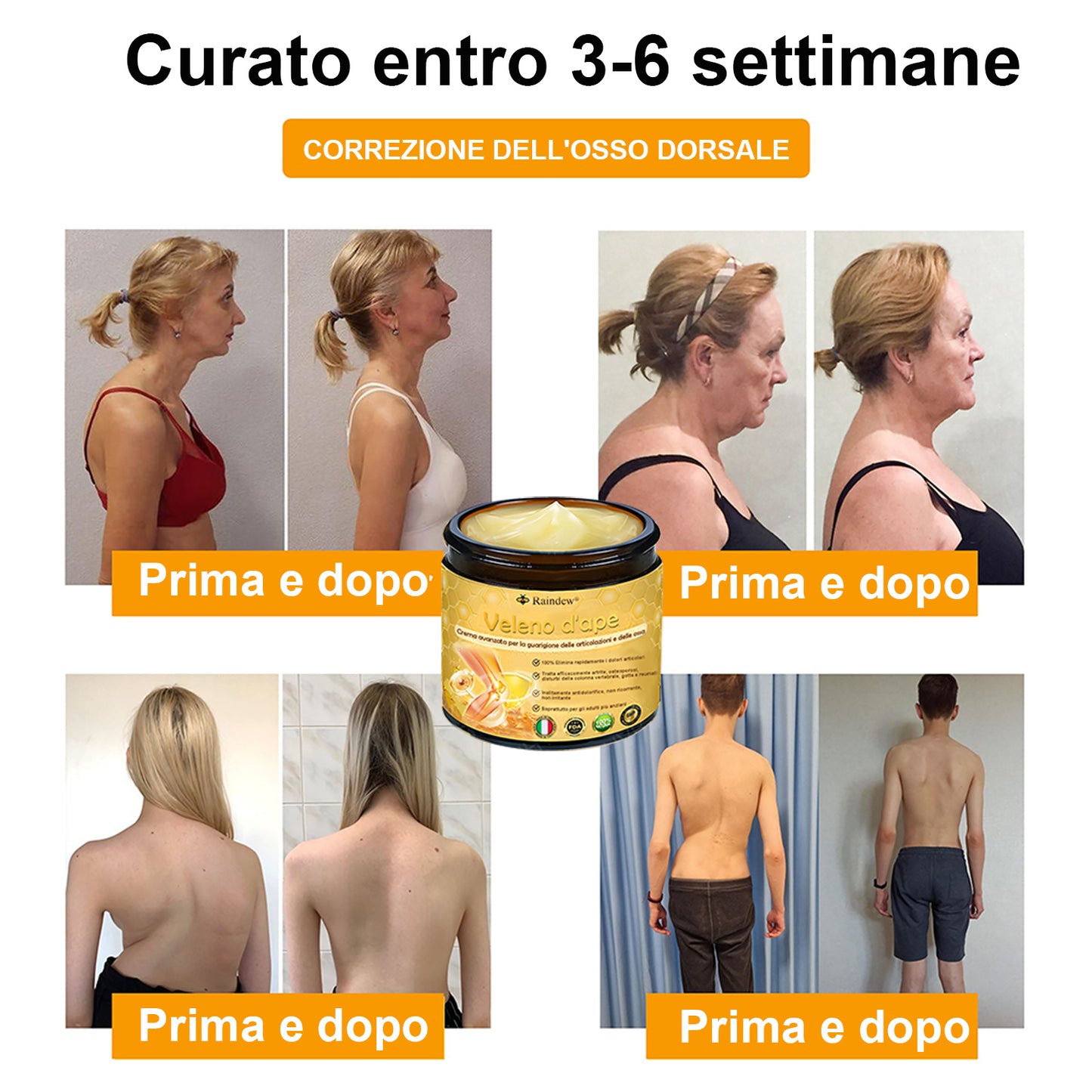 Raindew® Crema Avanzata al Veleno d'Ape per la Guarigione delle Articolazioni e delle Ossa