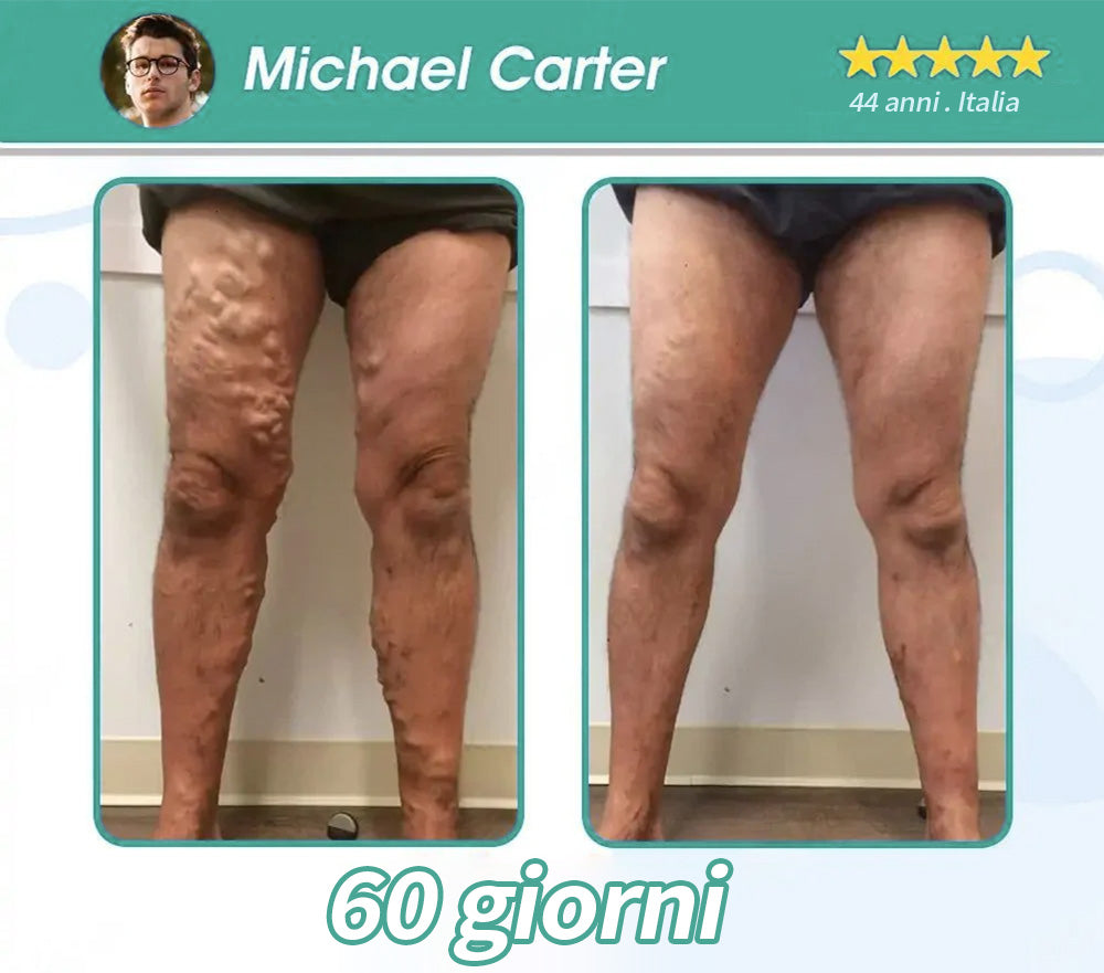 Honxi® Perle di essenza dimagrante GLP-1 🍏|Tripla azione: NAD⁺, Moringa e ACV|🔥 Brucia grassi veloce| Equilibrio metabolico