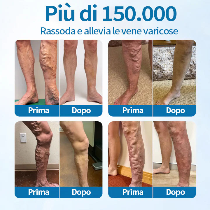 Lotmay® Spray alle erbe VeinGuard – ✅ Clinicamente testato per eliminare le vene varicose in soli 7 giorni!