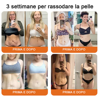Lotmay® 💧crema completa al veleno d'api 🔥 ULTIMO GIORNO 80% di sconto💎