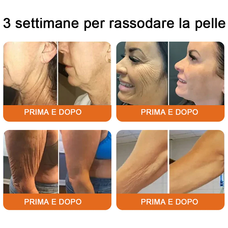 Lotmay® 💧crema completa al veleno d'api 🔥 ULTIMO GIORNO 80% di sconto💎