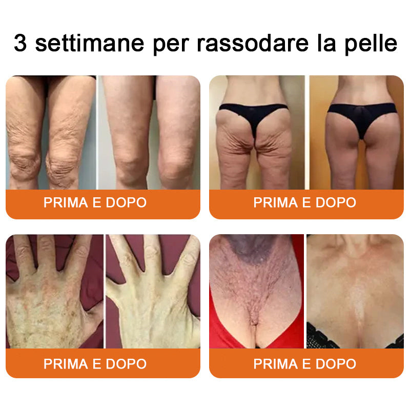 Lotmay® 💧crema completa al veleno d'api 🔥 ULTIMO GIORNO 80% di sconto💎