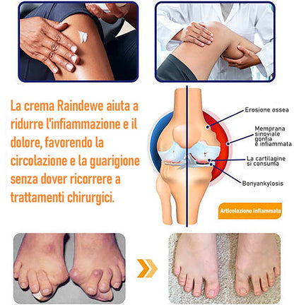 Raindew® Crema Avanzata al Veleno d'Ape per la Guarigione delle Articolazioni e delle Ossa