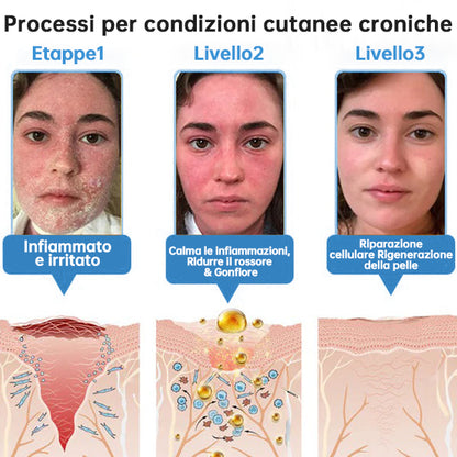 Lotmay® 🔥crema per il trattamento della pelle al veleno d'ape multi-stmptom
