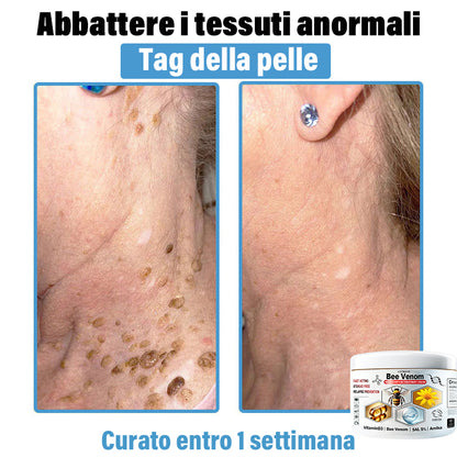 Lotmay® 🔥crema per il trattamento della pelle al veleno d'ape multi-stmptom