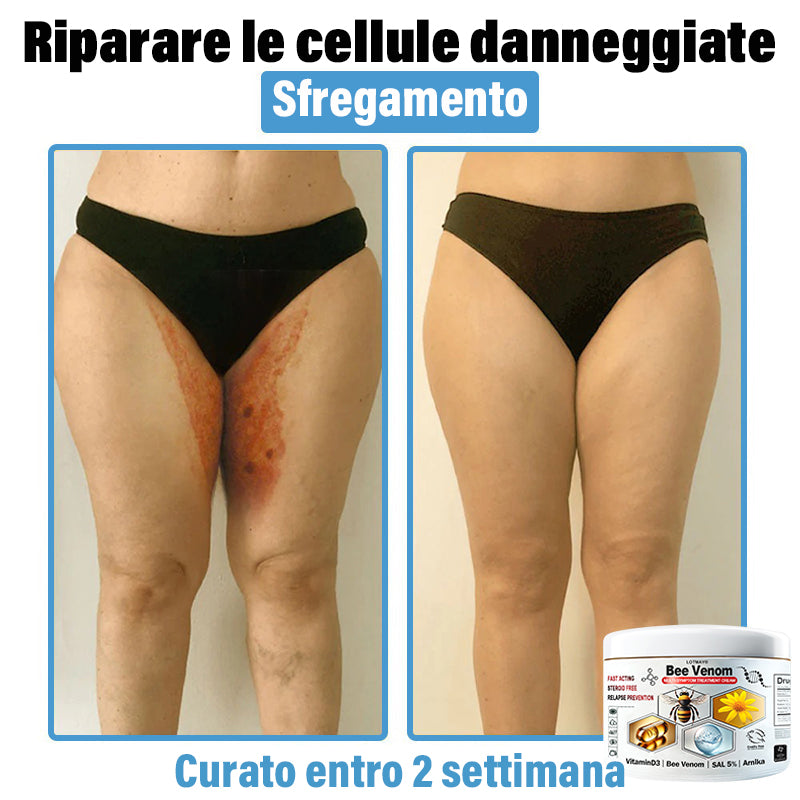 Lotmay® 🔥crema per il trattamento della pelle al veleno d'ape multi-stmptom