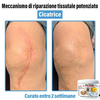 Lotmay® 🔥crema per il trattamento della pelle al veleno d'ape multi-stmptom