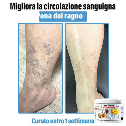 Lotmay® 🔥crema per il trattamento della pelle al veleno d'ape multi-stmptom